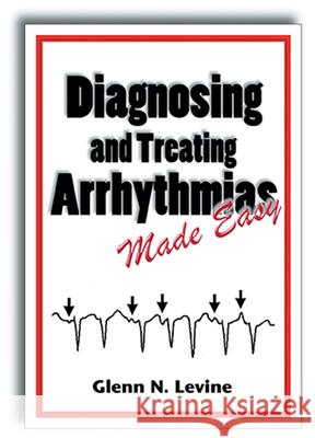 Diagnosing and Treating Arrhythmias Made Easy Glenn Levine   9781626236967