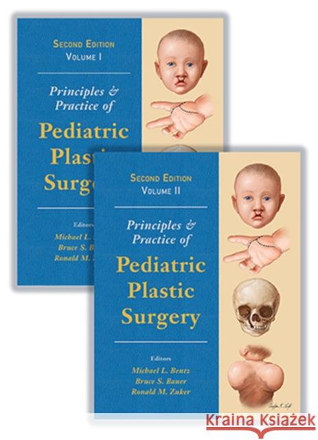 Principles and Practice of Pediatric Plastic Surgery Bentz, Michael 9781626237001