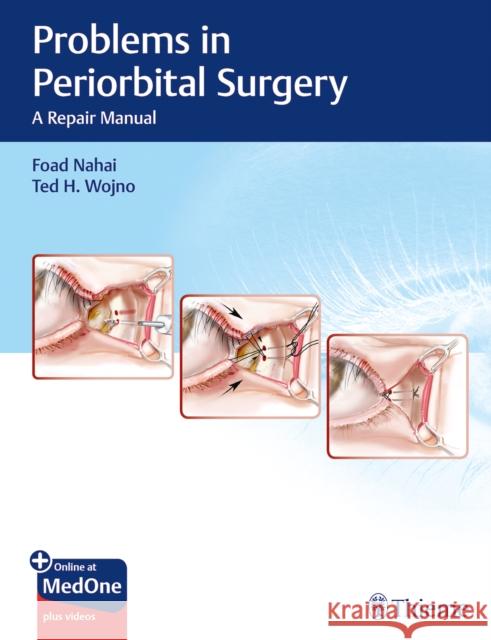 Problems in Periorbital Surgery: A Repair Manual Nahai, Foad 9781626237087 Thieme Medical Publishers