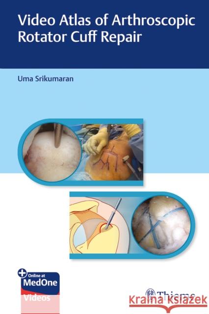 Video Atlas of Arthroscopic Rotator Cuff Repair Uma Srikumaran 9781626237124 Thieme Medical Publishers