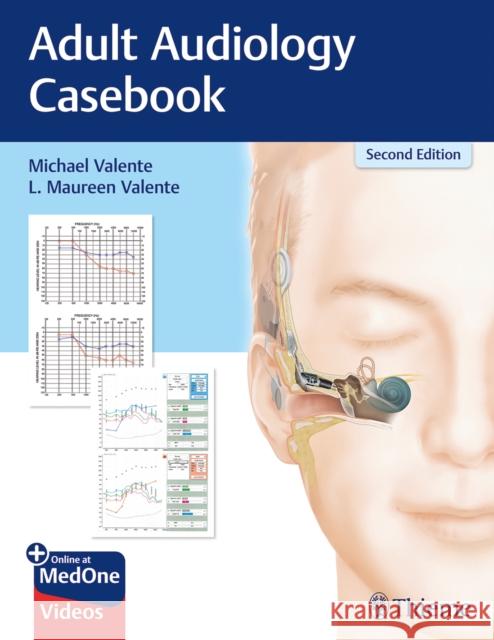 Adult Audiology Casebook Valente, Michael 9781626237292 Thieme Medical Publishers