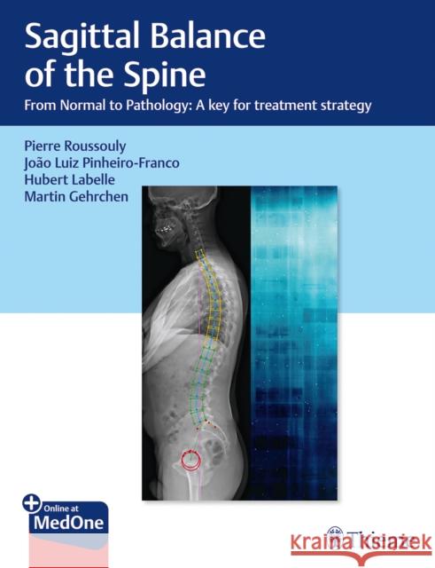 Sagittal Balance of the Spine: From Normal to Pathology: A Key for Treatment Strategy Roussouly, Pierre 9781626237322 Thieme Medical Publishers