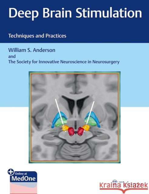 Deep Brain Stimulation: Techniques and Practices Anderson, William S. 9781626237971 Thieme Medical Publishers