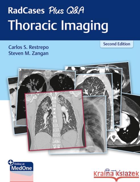 Radcases Plus Q&A Thoracic Imaging Carlos Restrepo Steven Zangan 9781626238145 Thieme Medical Publishers