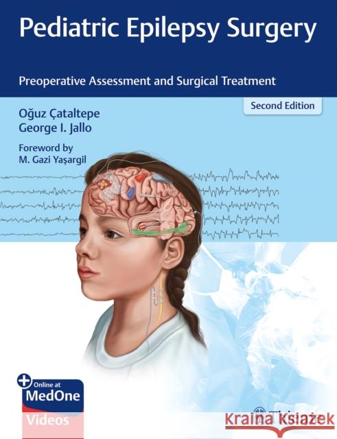 Pediatric Epilepsy Surgery: Preoperative Assessment and Surgical Treatment Cataltepe, Oguz 9781626238169 Thieme Medical Publishers