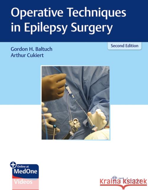 Operative Techniques in Epilepsy Surgery Villemure, Jean-Guy 9781626238183 Thieme Medical Publishers