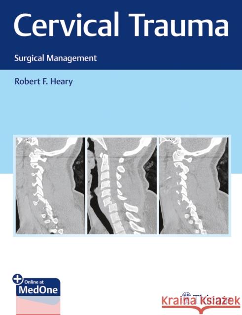 Cervical Trauma: Surgical Management Heary, Robert 9781626238534 Thieme Medical Publishers