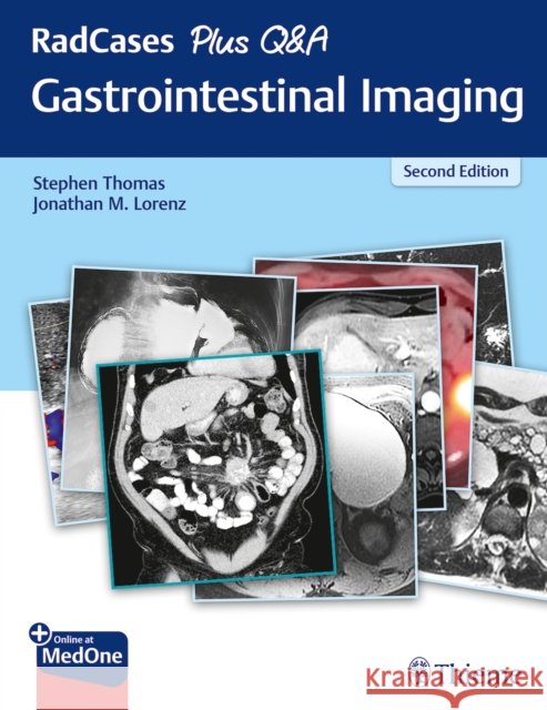 Radcases Plus Q&A Gastrointestinal Imaging Thomas, Stephen 9781626238688 Thieme Medical Publishers