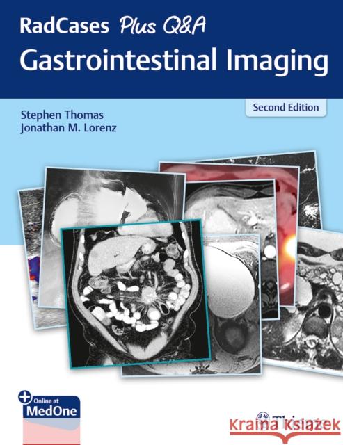 Radcases Plus Q&A Gastrointestinal Imaging Thomas, Stephen 9781626238688