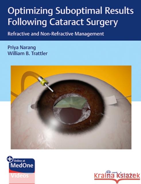 Optimizing Suboptimal Results Following Cataract Surgery: Refractive and Non-Refractive Management Priya Narang William Trattler 9781626238954