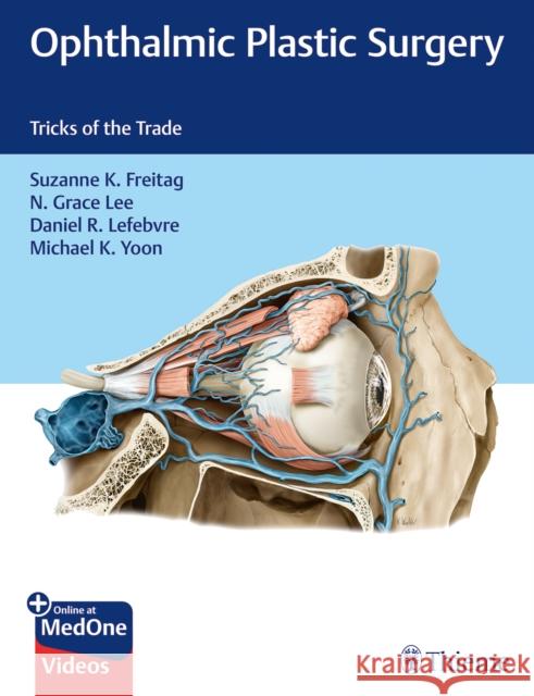 Ophthalmic Plastic Surgery: Tricks of the Trade Freitag, Suzanne 9781626238978