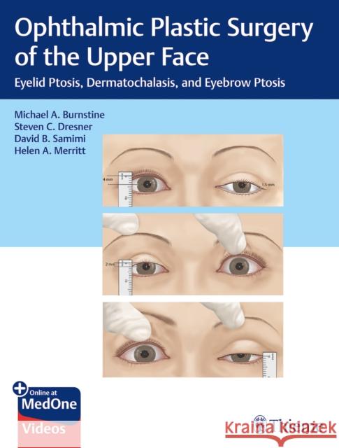 Ophthalmic Plastic Surgery of the Upper Face: Eyelid Ptosis, Dermatochalasis, and Eyebrow Ptosis Burnstine, Michael A. 9781626239210 Thieme Medical Publishers