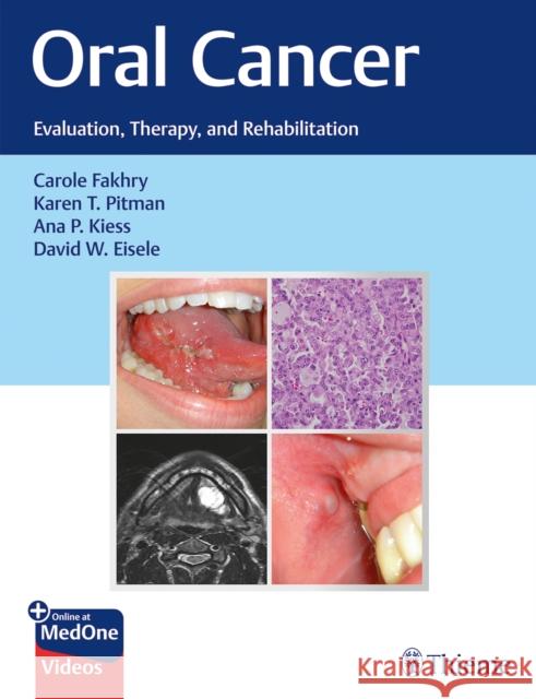 Oral Cancer: Evaluation, Therapy, and Rehabilitation Fakhry, Carole 9781626239685 Thieme Medical Publishers Inc