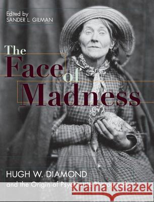 Face of Madness: Hugh W. Diamond and the Origin of Psychiatric Photography Sander L. Gilman Hugh W. Diamond John Conolly 9781626542396 Echo Point Books & Media