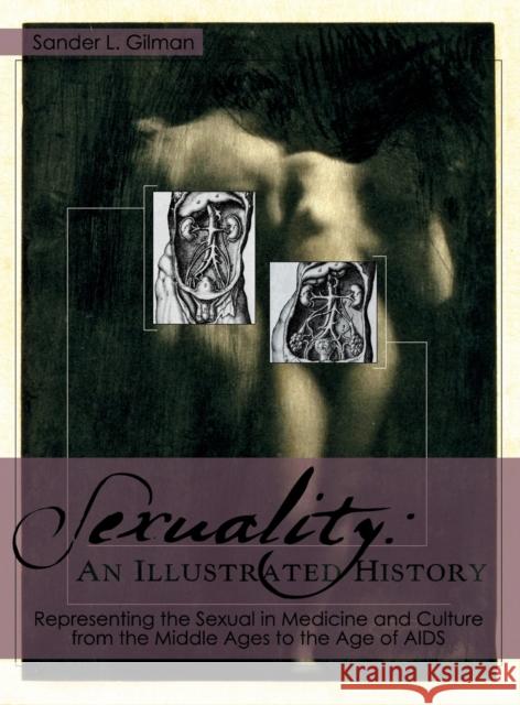 Sexuality: An Illustrated History Sander L. Gilman 9781626549210 Echo Point Books & Media