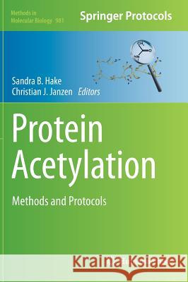 Protein Acetylation: Methods and Protocols Hake, Sandra B. 9781627033046 Humana Press