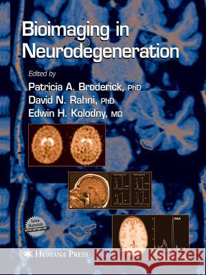 Bioimaging in Neurodegeneration Patricia a. Broderick David N. Rahni Edwin H. Kolodny 9781627038119