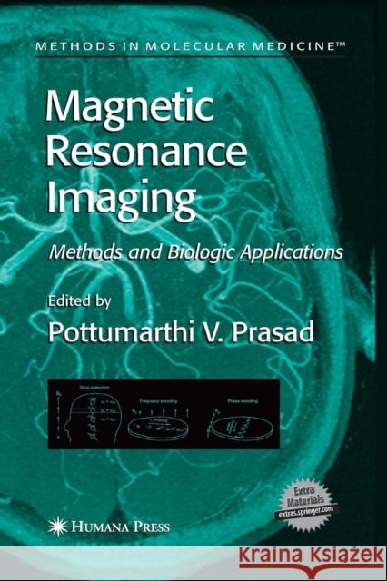 Magnetic Resonance Imaging: Methods and Biologic Applications Prasad, Pottumarthi V. 9781627038126 Humana Press