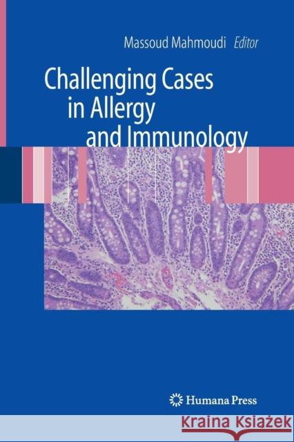 Challenging Cases in Allergy and Immunology Massoud Mahmoudi   9781627038355 Humana Press