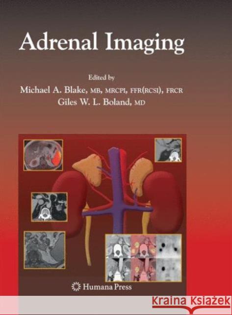 Adrenal Imaging Michael A. Blake Giles Boland 9781627038577 Humana Press