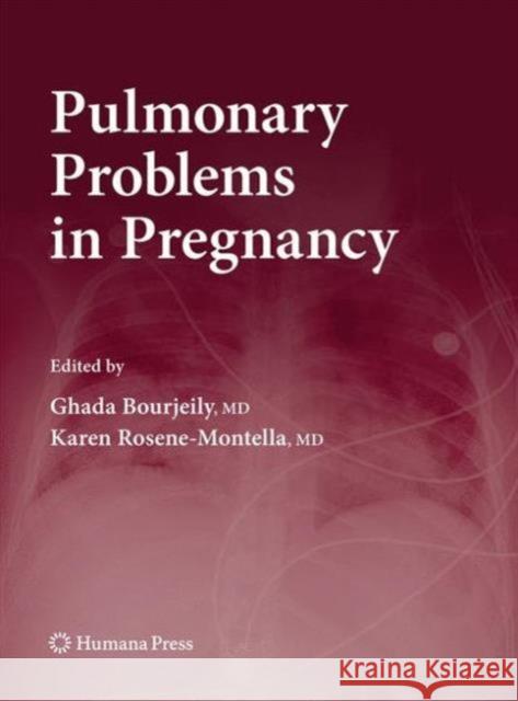 Pulmonary Problems in Pregnancy Ghada Bourjeily (Brown University, Warre Karen Rosene-Montella  9781627038591 Humana Press