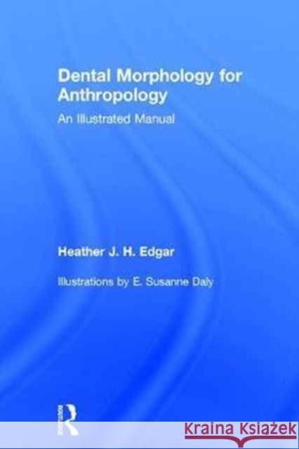 Dental Morphology for Anthropology: An Illustrated Manual Heather J. H. Edgar 9781629585116