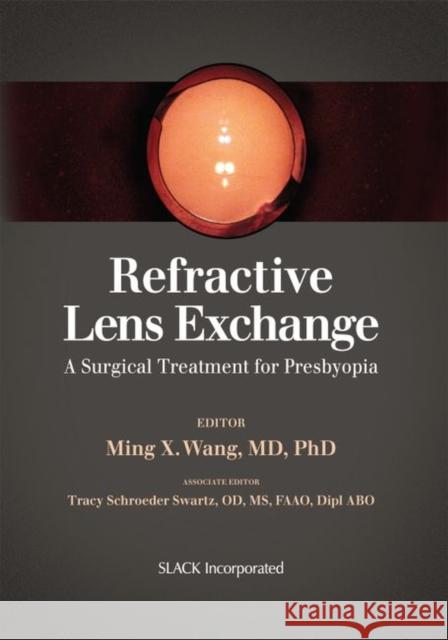 Refractive Lens Exchange: A Surgical Treatment for Presbyopia Ming Wang 9781630910716 Slack