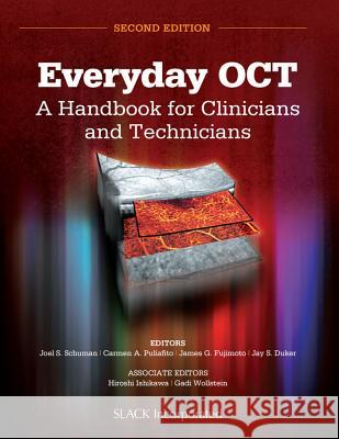 Everyday Oct: A Handbook for Clinicians and Technicians Joel S. Schuman Carmen A. Puliafito James G. Fujimoto 9781630911720 SLACK  Incorporated