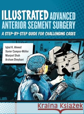 Illustrated Advanced Anterior Segment Surgery: A Step-By-Step Guide for Challenging Cases I. Ahmed 9781630911843 Slack