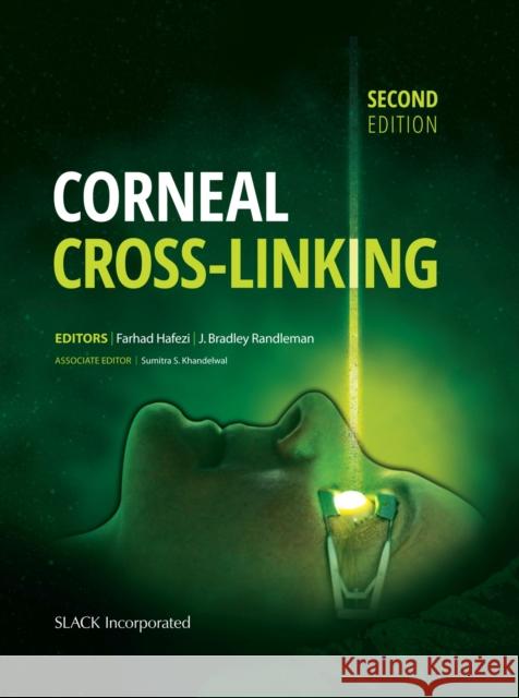 Corneal Cross-Linking Farhad Hafezi J. Bradley Randleman 9781630912109 Slack