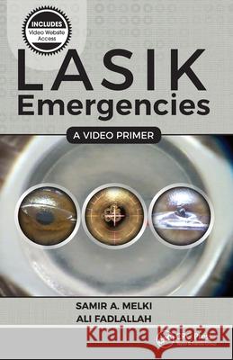 Lasik Emergencies: A Video Primer Samir A. Melki Ali Fadlallah 9781630912628