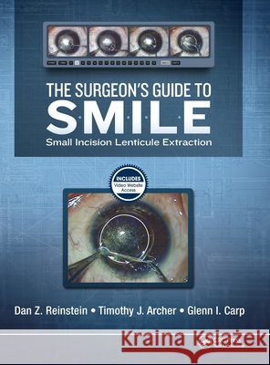 The Surgeon's Guide to Smile: Small Incision Lenticule Extraction Dan Z. Reinstein Timothy J. Archer Marine Gobbe 9781630912659