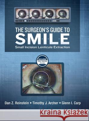 The Surgeon's Guide to Smile: Small Incision Lenticule Extraction Dan Z. Reinstein Timothy J. Archer Marine Gobbe 9781630912659 Slack