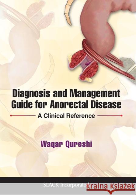 Diagnosis and Management Guide for Anorectal Disease: A Clinical Reference Qureshi, Waqar Ahmed 9781630914929