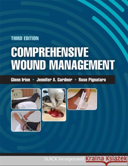 Comprehensive Wound Management Glenn Irion, Jennifer Gardner, Rose Pignataro 9781630915216