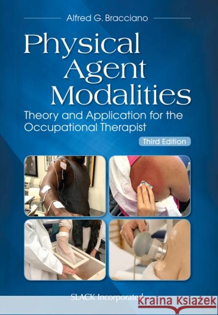 Physical Agent Modalities: Theory and Application for the Occupational Therapist Alfred Bracciano 9781630915384 SLACK  Incorporated
