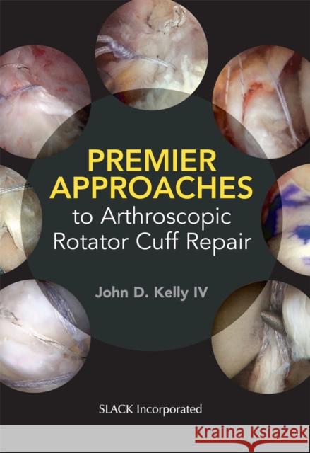 Premier Approaches to Arthroscopic Rotator Cuff Repair J. Kelly 9781630915629 Slack