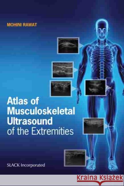 Atlas of Musculoskeletal Ultrasound of the Extremities Mohini Rawat 9781630916022