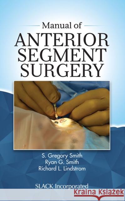 Manual of Anterior Segment Surgery S. Gregory Smith Ryan G. Smith Richard L. Lindstrom 9781630916206 SLACK  Incorporated