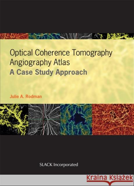 Optical Coherence Tomography Angiography Atlas: A Case Study Approach Julie A. Rodman Dan Esmaili 9781630916411