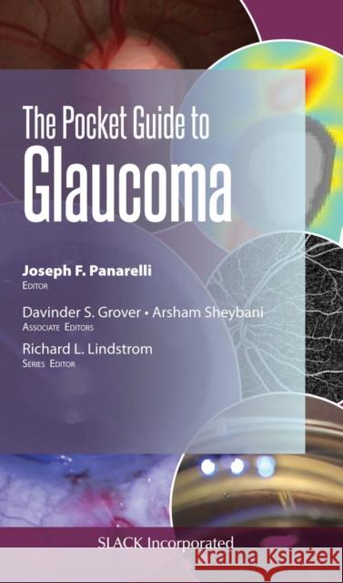 The Pocket Guide to Glaucoma J. Panarelli 9781630916701 Slack