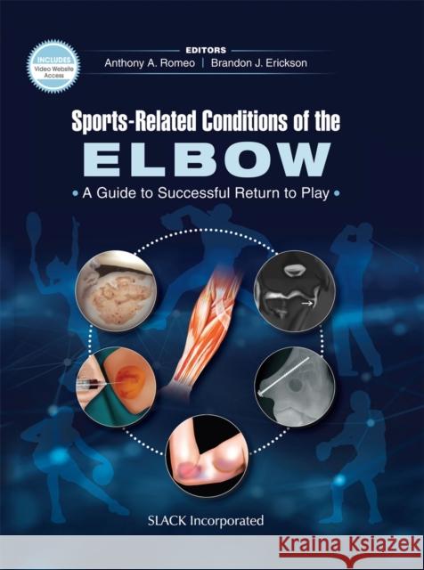 Sports-Related Conditions of the Elbow: A Guide to Successful Return to Play Romeo, Anthony A. 9781630917838