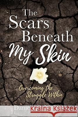 The Scars Beneath My Skin: Overcoming the Struggle Within Danielle S McDole 9781631297861