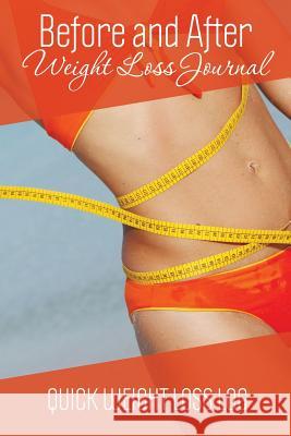 Before and After Weight Loss Journal: Quick Weight Loss Log Speedy Publishing LLC 9781631870095 Speedy Publishing LLC