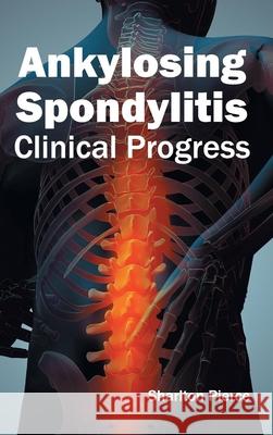 Ankylosing Spondylitis: Clinical Progress Sharlton Pierce 9781632410450 Hayle Medical