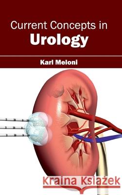 Current Concepts in Urology Karl Meloni 9781632411006 Hayle Medical