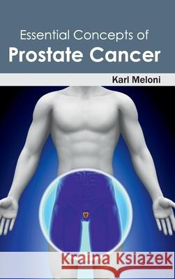 Essential Concepts of Prostate Cancer Karl Meloni 9781632412157 Hayle Medical