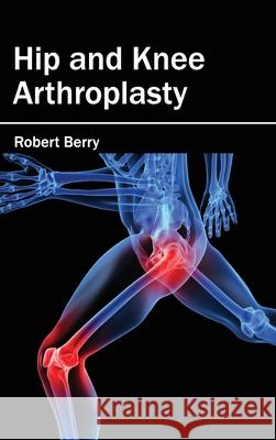 Hip and Knee Arthroplasty Robert Berry 9781632412515