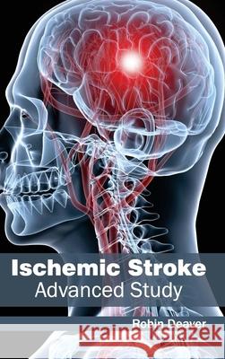 Ischemic Stroke: Advanced Study Robin Deaver 9781632412706 Hayle Medical