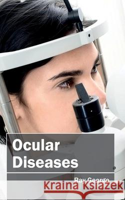 Ocular Diseases Ray George 9781632413031 Hayle Medical